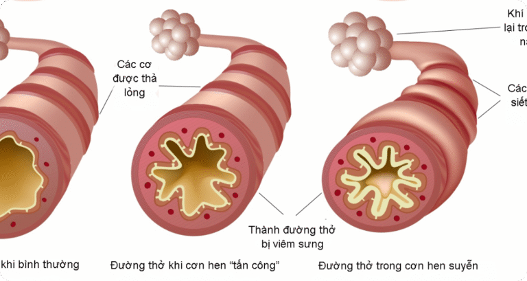 Sử dụng ICS trong HPQ cấp hiệu quả và An toàn